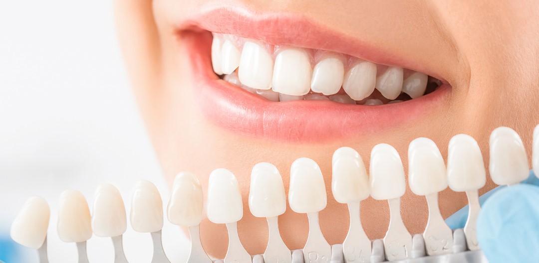 teeth whitening treatment in amalapuram